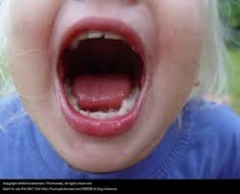 La salud bucodental en los niños